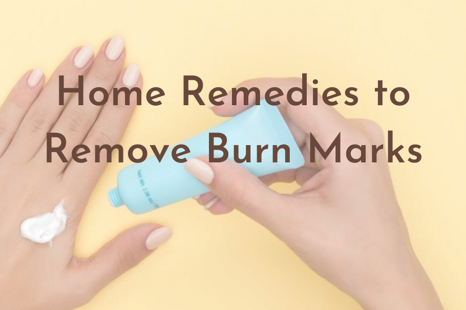 home-remedies-to-remove-burn marks